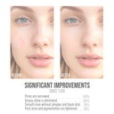 Niacinamide Serum for Face 20ML