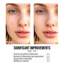 Exfoliating Face Serum AHA + BHA Peeling - Exfoliating